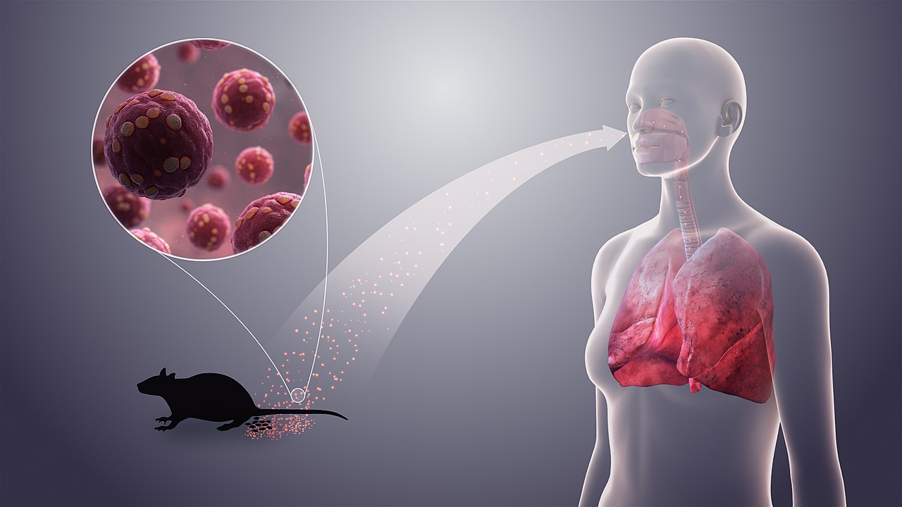 US Hantavirus Response Is Still Alarmingly Inadequate